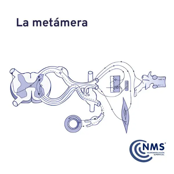La Metámera